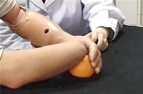 奥托博克假肢